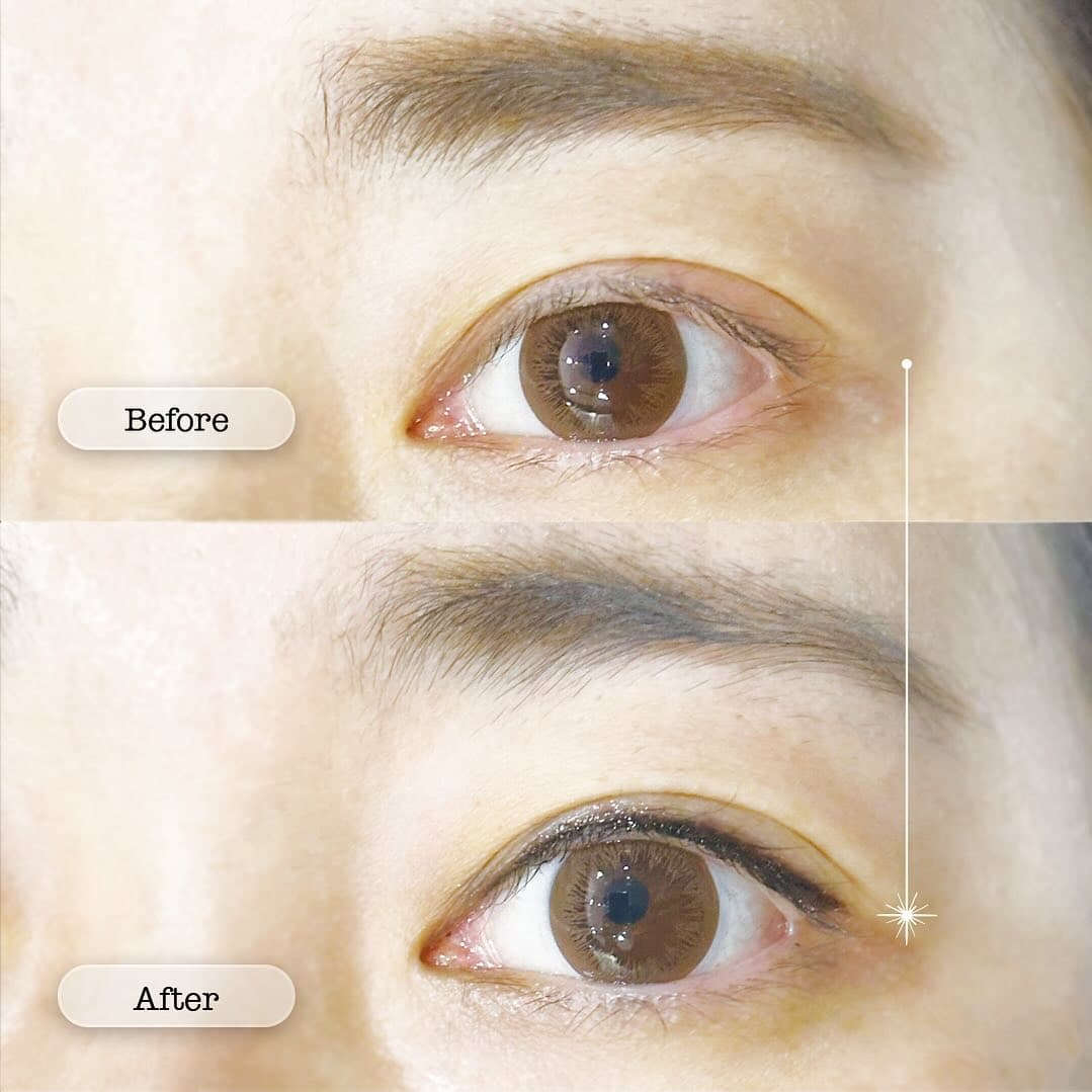 Permanent eyeliner before and after Toronto — tattooed eyeliner at The Black Light